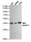 Anti-WDR77 Antibody (8A10-C10-E8)